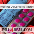 Imágenes De La Píldora Tadalafil 35